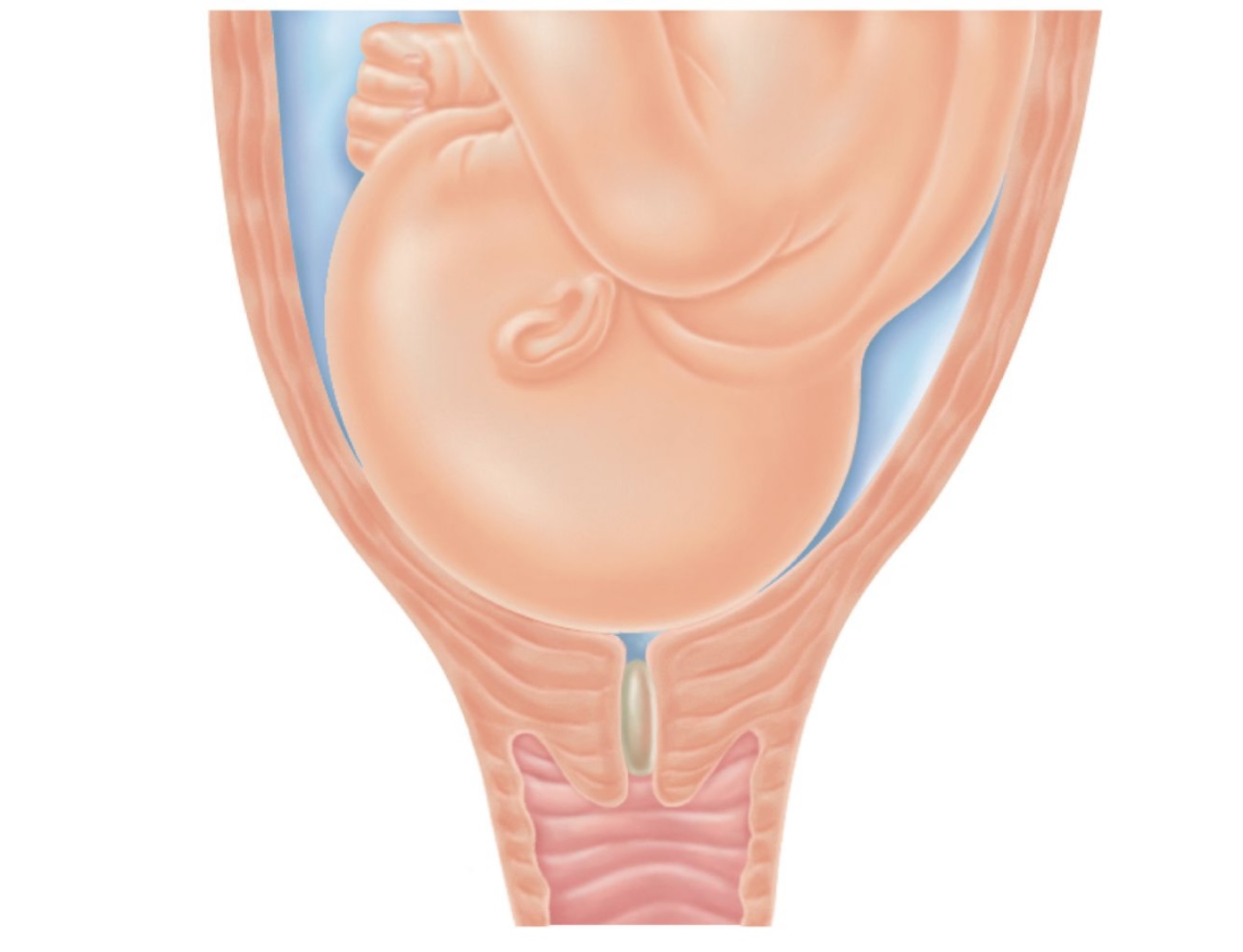 Understanding Mucus Plug 1