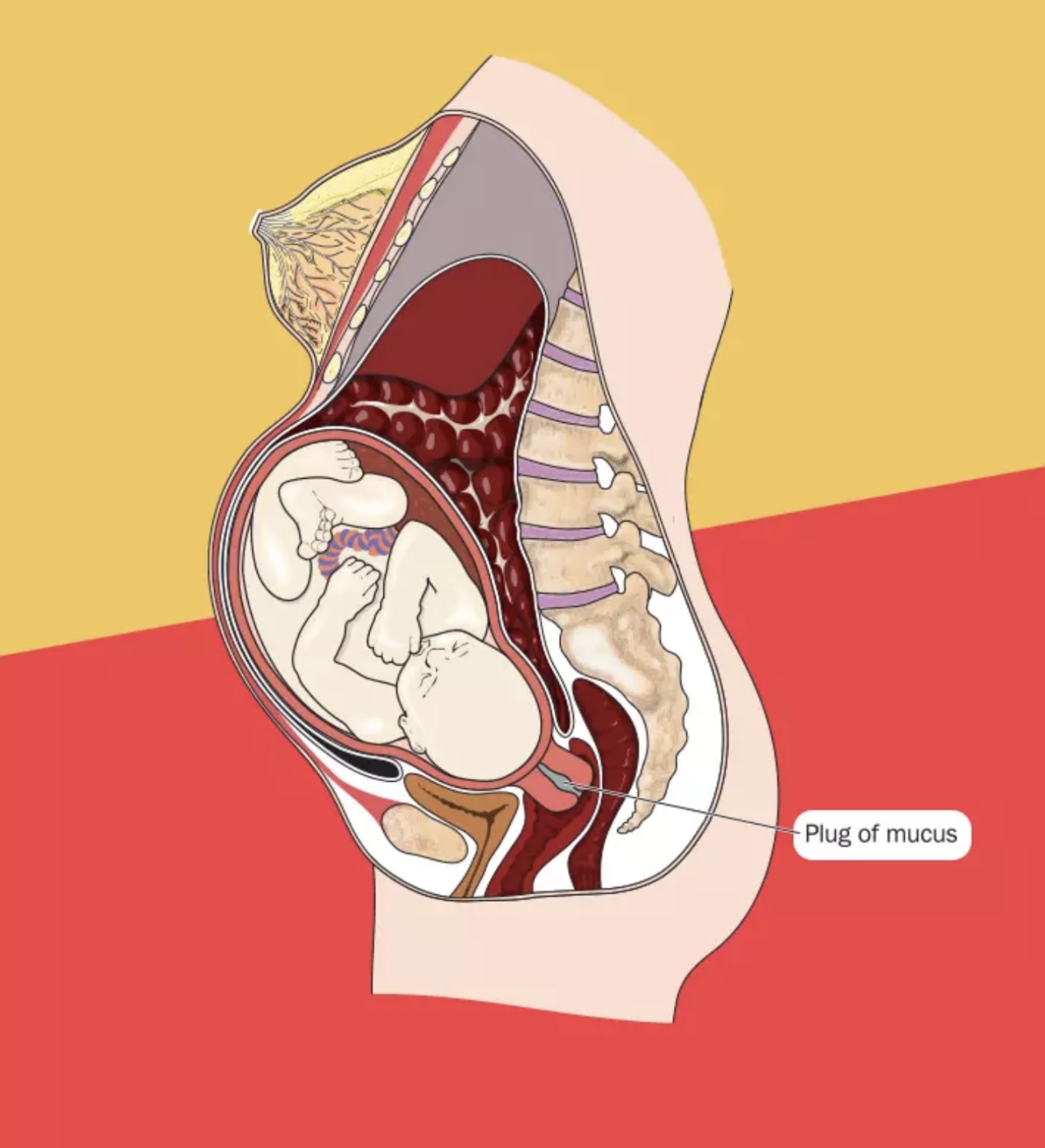 Understanding Mucus Plug 2